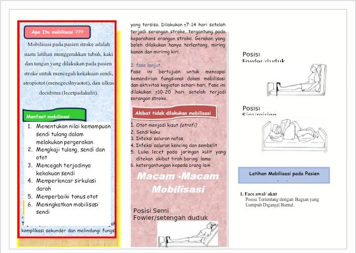 Ilustrasi mobilisasi pasien stroke